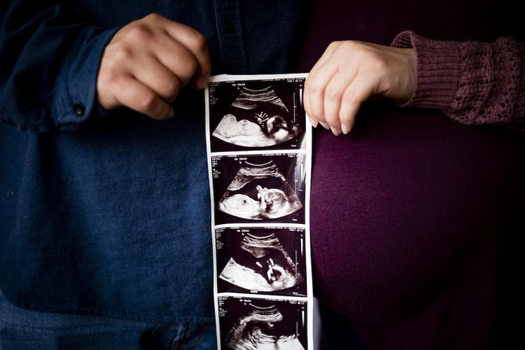 Michael Irvine and Leah Nelson (here holding a sonogram of their unborn baby)